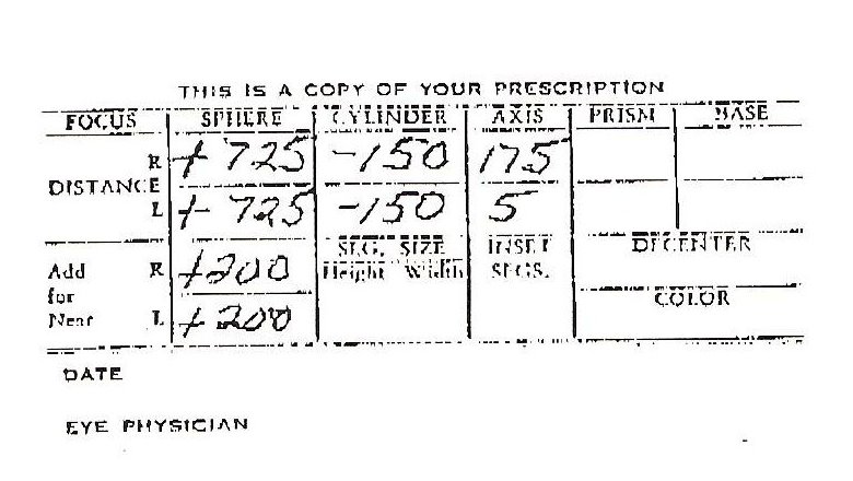 Prescription for glasses: R: Sphere +7.25, Cylinder -1.50, Axis 175, Add +2.00 L: Sphere +7.25, Cylinder -1.50, Axis 5, Add +2.00 Eye Physician.