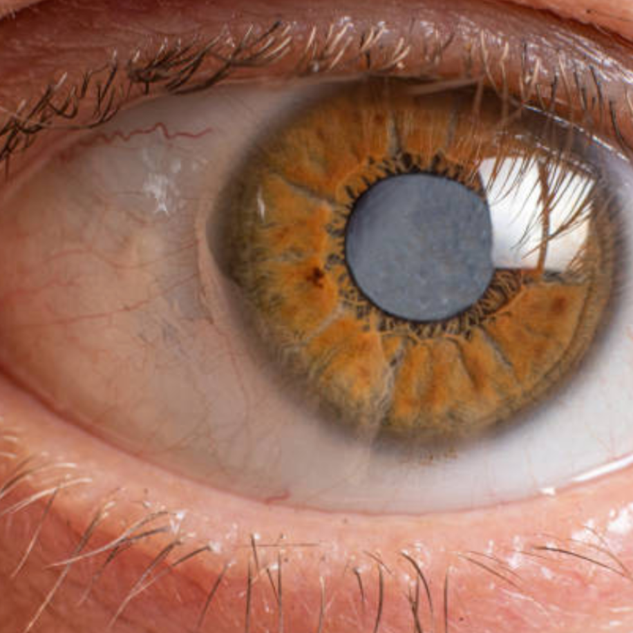 Close-up view of a human eye with orange, green, and brown hues in the iris and visible veins and eyelashes.