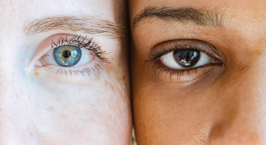 Close-up of two eyes, one with blue iris and one with brown iris, showcasing different eye colors.