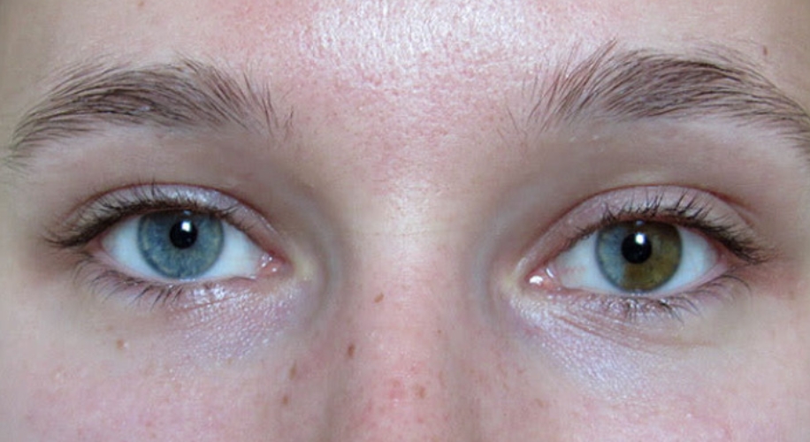 Unlocking the Mystery: Eye Color Genetics Explained